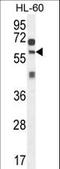 Zinc Finger SWIM-Type Containing 1 antibody, LS-C160974, Lifespan Biosciences, Western Blot image 