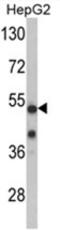 Cyclin-dependent kinase 14 antibody, AP17632PU-N, Origene, Western Blot image 