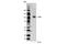 Toll Like Receptor 4 antibody, 14358S, Cell Signaling Technology, Western Blot image 