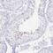 PR/SET Domain 7 antibody, PA5-63800, Invitrogen Antibodies, Immunohistochemistry paraffin image 