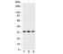Succinate Dehydrogenase Complex Iron Sulfur Subunit B antibody, R30808, NSJ Bioreagents, Western Blot image 
