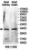 Potassium Channel Tetramerization Domain Containing 1 antibody, orb78142, Biorbyt, Western Blot image 