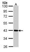 Cartilage Associated Protein antibody, NBP1-32884, Novus Biologicals, Western Blot image 