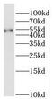 Retinoic Acid Receptor Gamma antibody, FNab07122, FineTest, Western Blot image 
