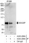 SSX Family Member 2 Interacting Protein antibody, A303-298A, Bethyl Labs, Immunoprecipitation image 