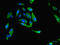 Methylenetetrahydrofolate Reductase antibody, LS-C369998, Lifespan Biosciences, Immunofluorescence image 