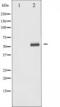 Checkpoint Kinase 1 antibody, TA325363, Origene, Western Blot image 