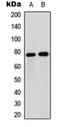 Forkhead Box O1 antibody, orb256540, Biorbyt, Western Blot image 