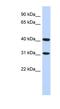 Terminal Nucleotidyltransferase 5D antibody, NBP1-56728, Novus Biologicals, Western Blot image 