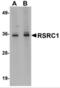 Arginine And Serine Rich Coiled-Coil 1 antibody, NBP2-81778, Novus Biologicals, Western Blot image 