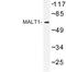 MALT1 Paracaspase antibody, LS-C177044, Lifespan Biosciences, Western Blot image 