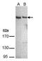 Phospholipase C Eta 1 antibody, GTX108612, GeneTex, Western Blot image 