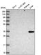 Glycine N-acyltransferase antibody, PA5-65376, Invitrogen Antibodies, Western Blot image 