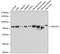 CBFA2/RUNX1 Partner Transcriptional Co-Repressor 2 antibody, GTX65822, GeneTex, Western Blot image 