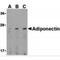 Adiponectin, C1Q And Collagen Domain Containing antibody, TA306227, Origene, Western Blot image 