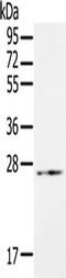 RAB21, Member RAS Oncogene Family antibody, TA351577, Origene, Western Blot image 