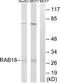 RAB18, Member RAS Oncogene Family antibody, TA315204, Origene, Western Blot image 