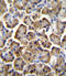Probetacellulin antibody, LS-C156880, Lifespan Biosciences, Immunohistochemistry paraffin image 