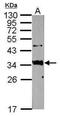 Sftpa antibody, PA5-28480, Invitrogen Antibodies, Western Blot image 