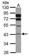 N-Acylsphingosine Amidohydrolase 1 antibody, PA5-34831, Invitrogen Antibodies, Western Blot image 