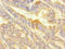 Integrin Subunit Alpha 2 antibody, A59490-100, Epigentek, Immunohistochemistry paraffin image 