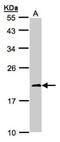 NADH dehydrogenase [ubiquinone] iron-sulfur protein 4, mitochondrial antibody, NBP1-31465, Novus Biologicals, Western Blot image 