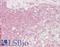 Lysosome-associated membrane glycoprotein 3 antibody, LS-B7698, Lifespan Biosciences, Immunohistochemistry paraffin image 