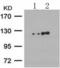 Protein Kinase D1 antibody, TA322963, Origene, Western Blot image 
