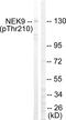 Serine/threonine-protein kinase Nek9 antibody, P04660, Boster Biological Technology, Western Blot image 