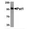 ST8 Alpha-N-Acetyl-Neuraminide Alpha-2,8-Sialyltransferase 4 antibody, TA160075, Origene, Western Blot image 