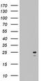 ADP Ribosylation Factor Like GTPase 3 antibody, LS-C336784, Lifespan Biosciences, Western Blot image 
