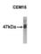 Apolipoprotein B MRNA Editing Enzyme Catalytic Subunit 3G antibody, abx025163, Abbexa, Western Blot image 