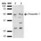 Presenilin 1 antibody, LS-C776557, Lifespan Biosciences, Western Blot image 