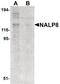 NLR Family Pyrin Domain Containing 8 antibody, PA5-21024, Invitrogen Antibodies, Western Blot image 