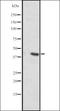 Solute Carrier Family 35 Member C2 antibody, orb335283, Biorbyt, Western Blot image 