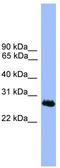 Chromosome 1 Open Reading Frame 216 antibody, TA338830, Origene, Western Blot image 