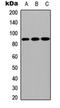 Carboxypeptidase X, M14 Family Member 2 antibody, orb256468, Biorbyt, Western Blot image 