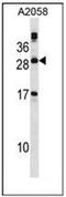 Phospholipase A2 Group XIIA antibody, AP53322PU-N, Origene, Western Blot image 