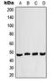 Casein Kinase 1 Delta antibody, LS-C352047, Lifespan Biosciences, Western Blot image 