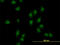 AT-Rich Interaction Domain 1B antibody, LS-C133798, Lifespan Biosciences, Immunofluorescence image 