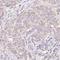 Endothelial cell-selective adhesion molecule antibody, HPA056293, Atlas Antibodies, Immunohistochemistry paraffin image 