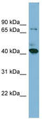 HERPUD Family Member 2 antibody, TA338602, Origene, Western Blot image 