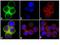 c-met antibody, 710792, Invitrogen Antibodies, Immunofluorescence image 