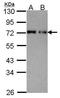 Nuclear pore glycoprotein p62 antibody, TA307982, Origene, Western Blot image 