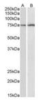 Cytochrome P450 2B6 antibody, orb318732, Biorbyt, Western Blot image 