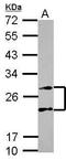 Proteasome Subunit Alpha 4 antibody, GTX104896, GeneTex, Western Blot image 