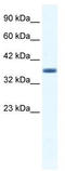 PAP-III antibody, TA341650, Origene, Western Blot image 