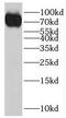 Immunoglobulin Heavy Constant Mu antibody, FNab04185, FineTest, Western Blot image 