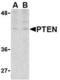 Phosphatidylinositol-3,4,5-trisphosphate 3-phosphatase and dual-specificity protein phosphatase PTEN antibody, TA306224, Origene, Western Blot image 