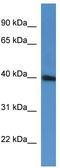 Pre-MRNA Processing Factor 38A antibody, TA343030, Origene, Western Blot image 